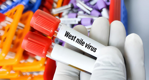 West Nile virus in Italia: 84 casi confermati, due decessi da febbraio
